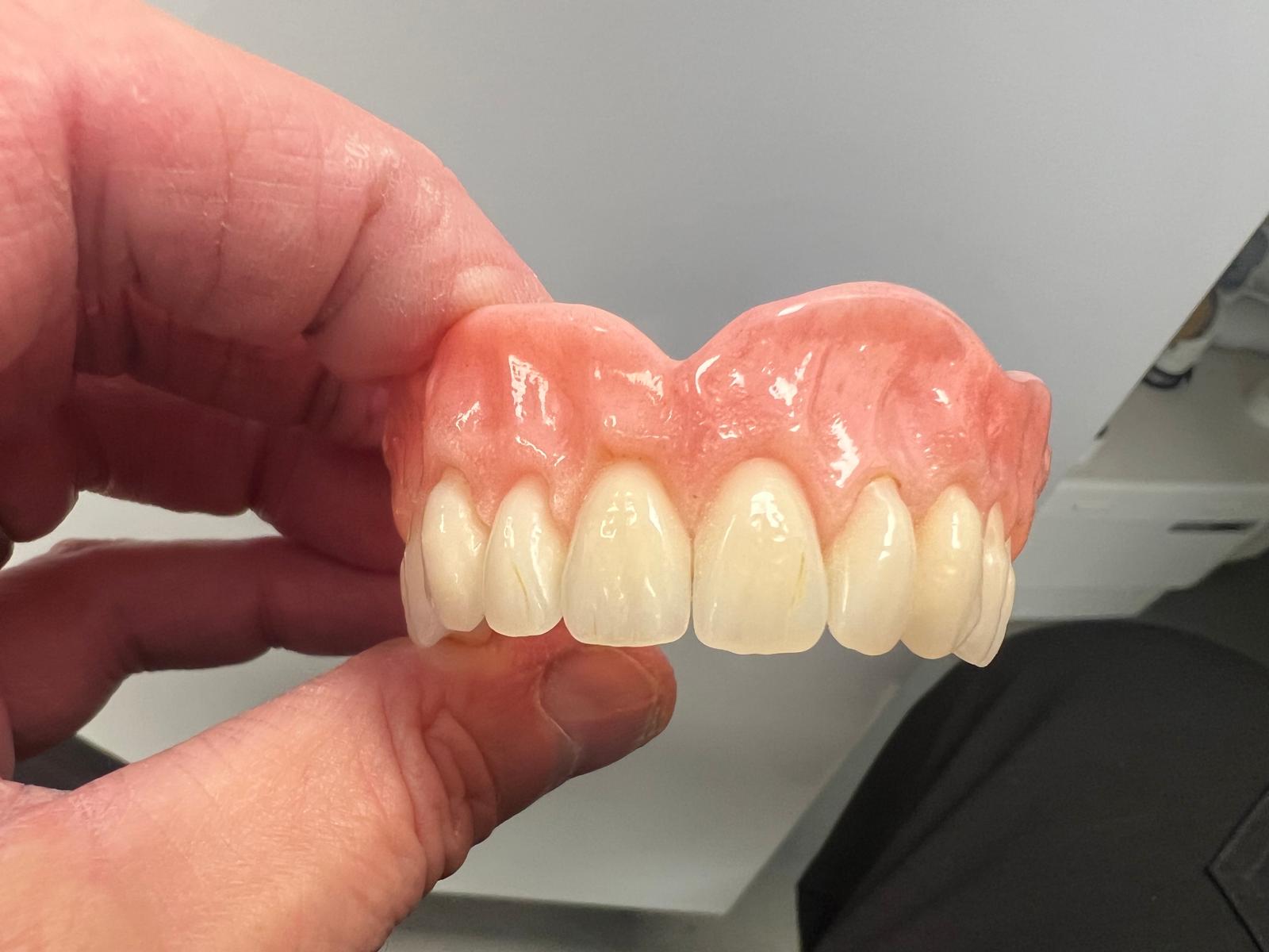 Palette Denture